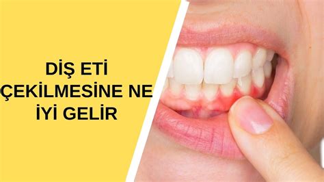 diş kemik erimesine ne iyi gelir bitkisel